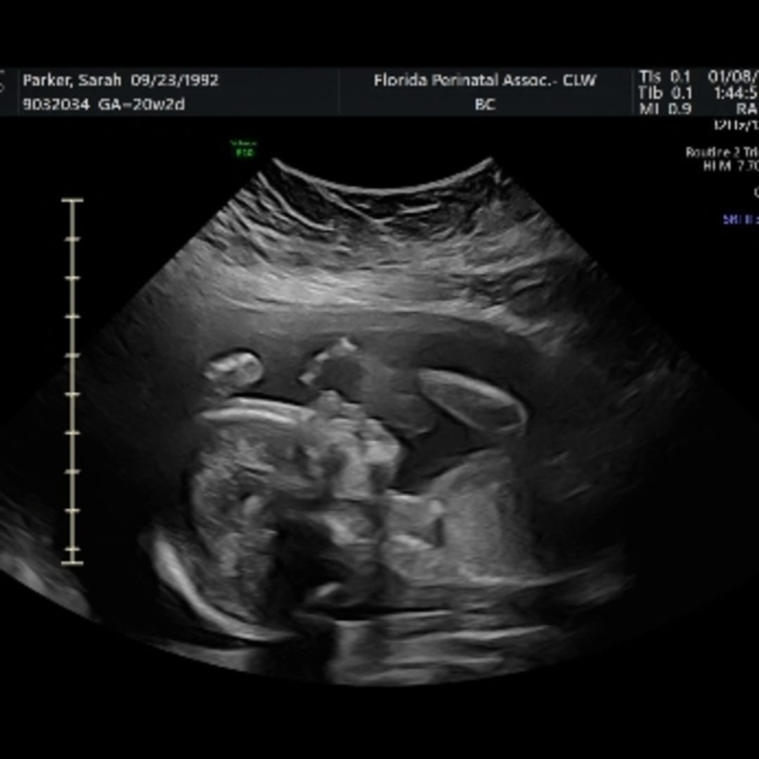 Photo shared by Sarah for their Babylist baby registry.