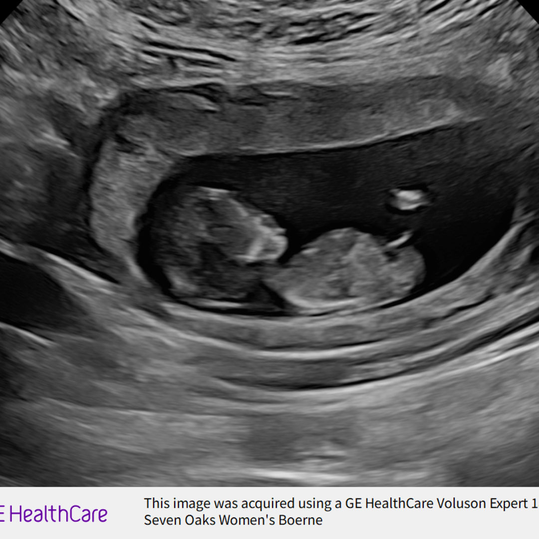 Photo shared by Sarah for their Babylist baby registry.