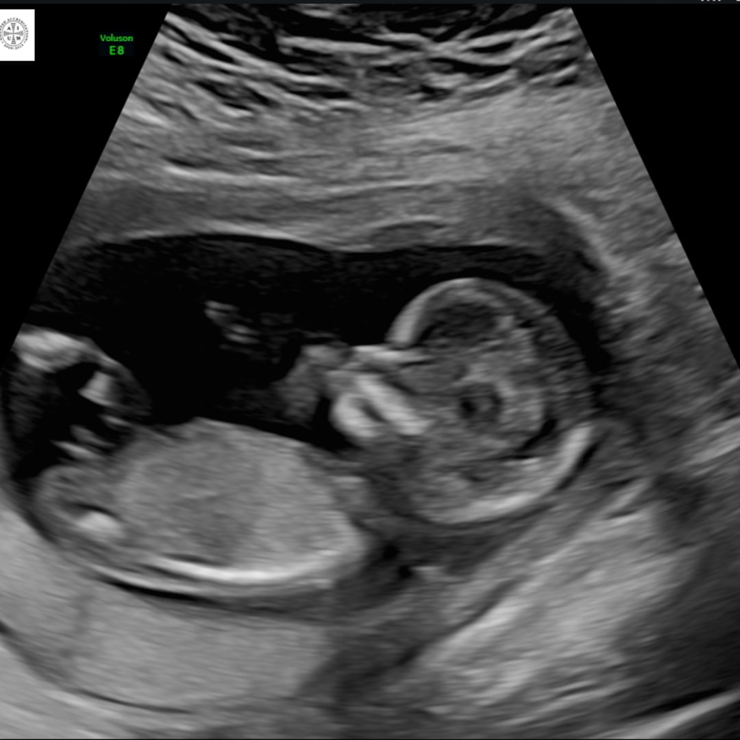 Photo shared by Katie for their Babylist baby registry.