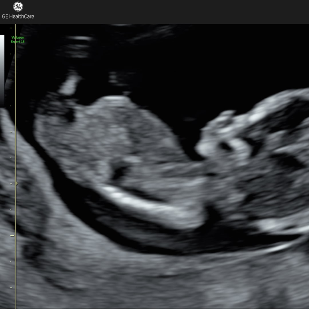 Photo shared by Brooke for their Babylist baby registry.