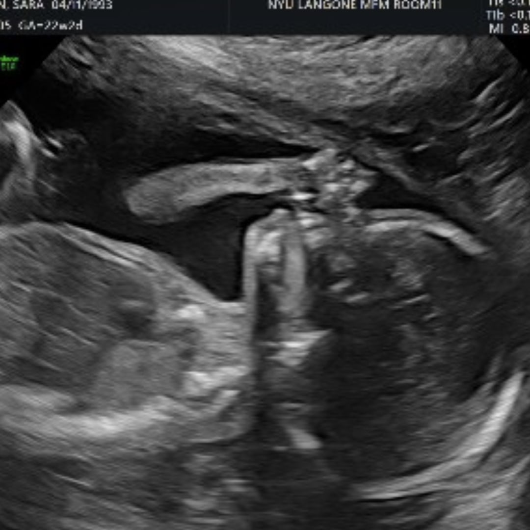 Photo shared by Sara for their Babylist baby registry.