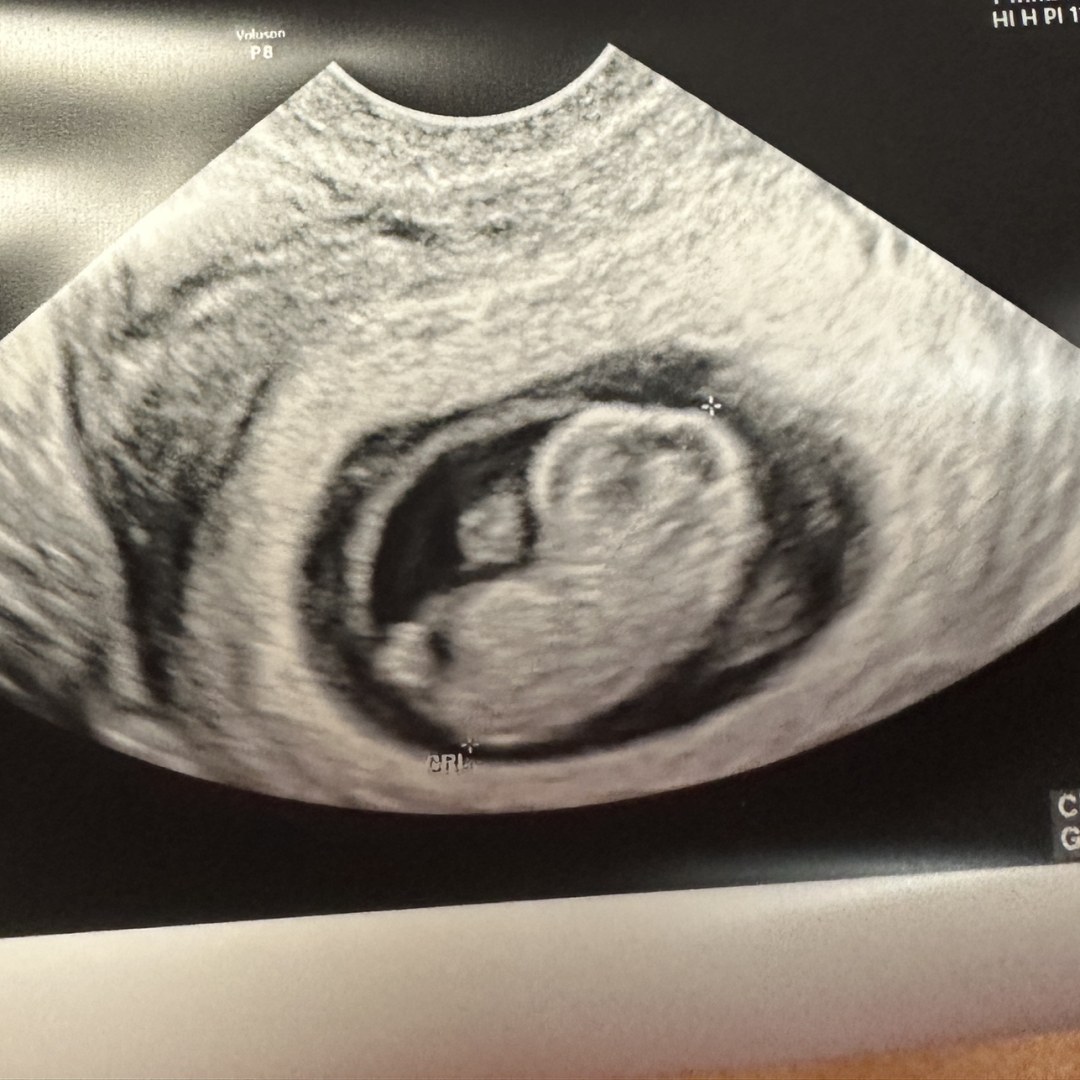 Photo shared by Nina for their Babylist baby registry.