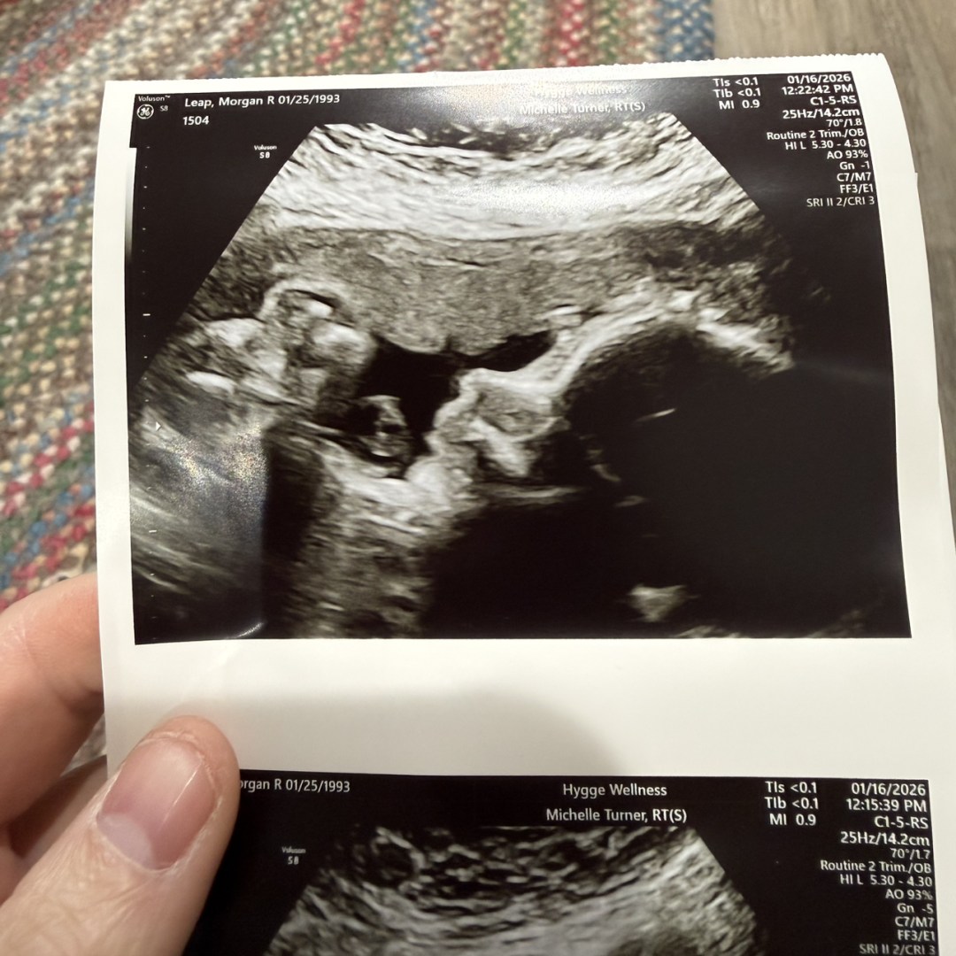 Photo shared by Morgan for their Babylist baby registry.