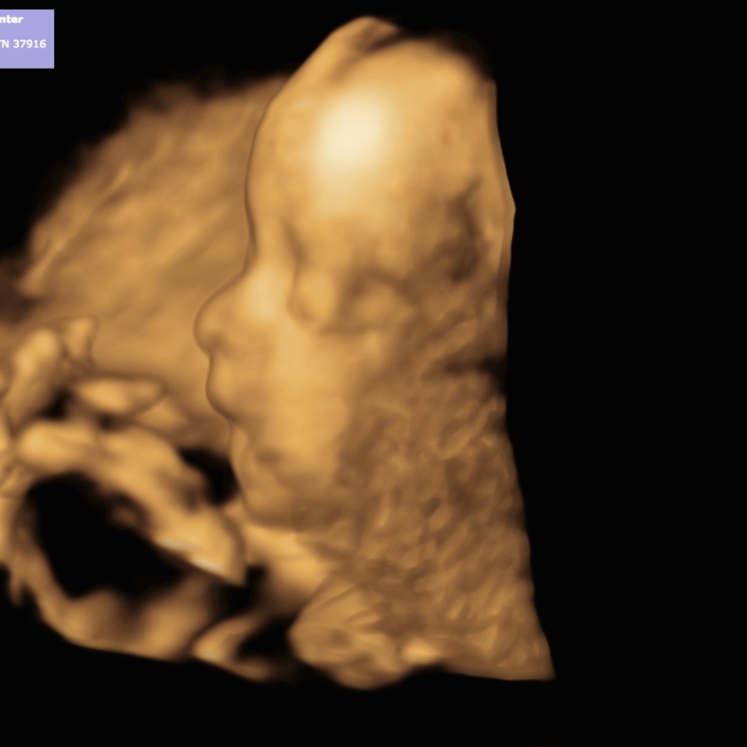 Photo shared by Savonnah for their Babylist baby registry.
