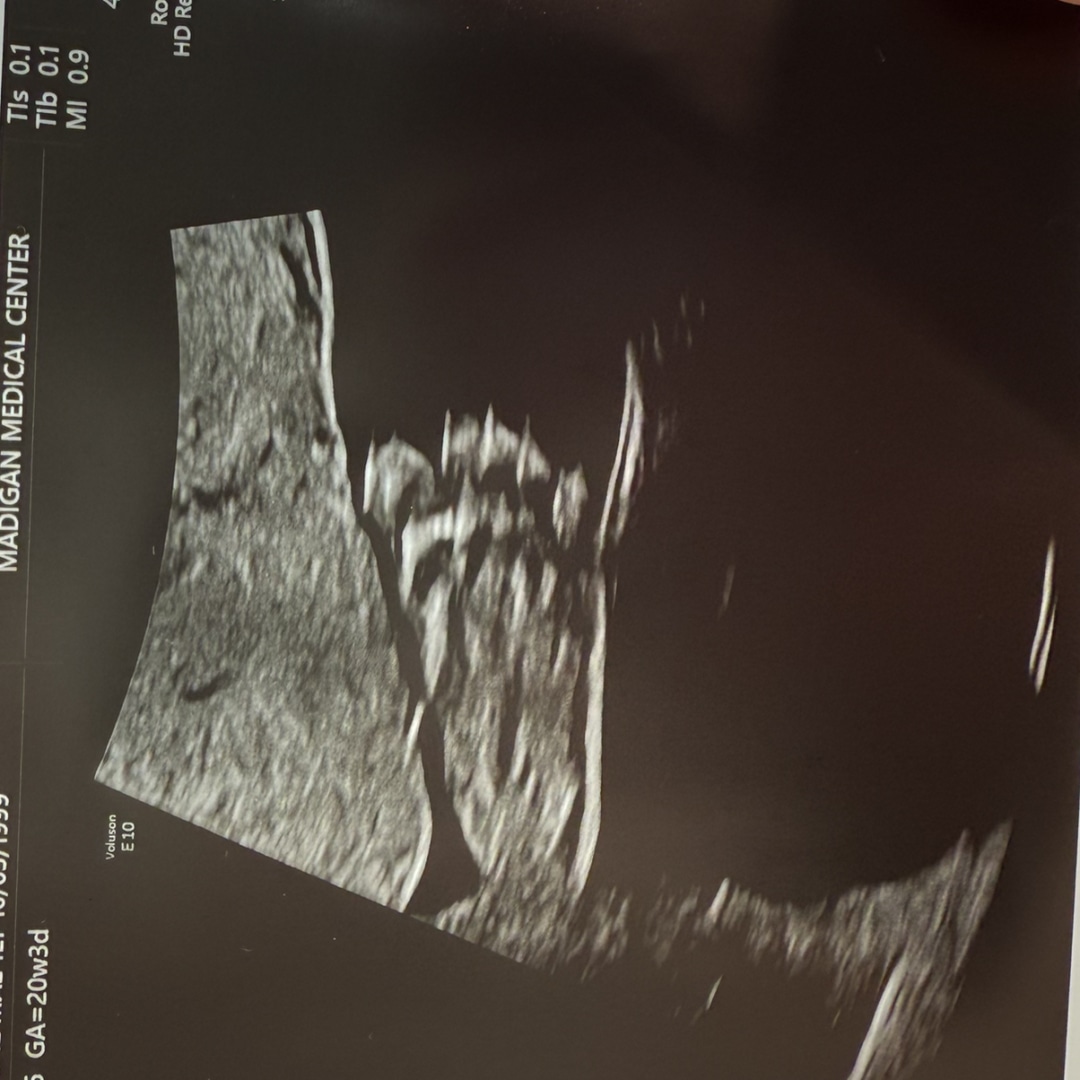 Photo shared by Corrine for their Babylist baby registry.