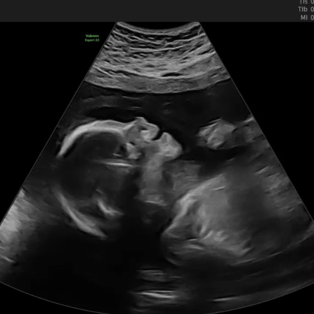 Photo shared by Gwendolyn for their Babylist baby registry.