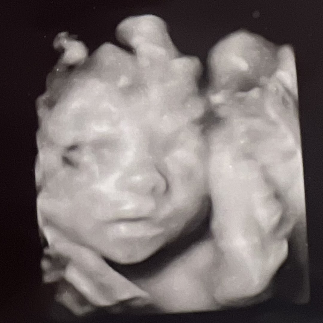 Photo shared by Elda for their Babylist baby registry.