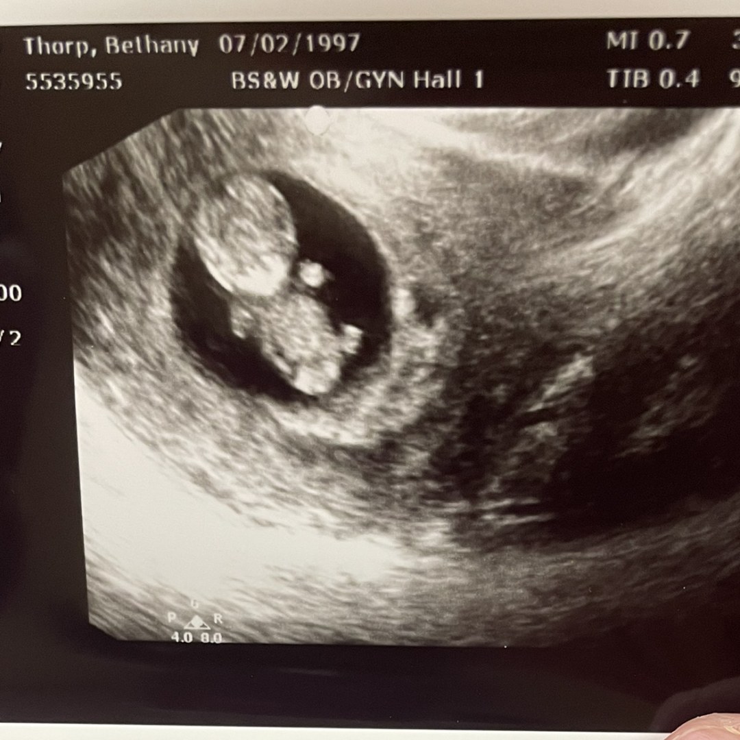 Photo shared by Bethany for their Babylist baby registry.