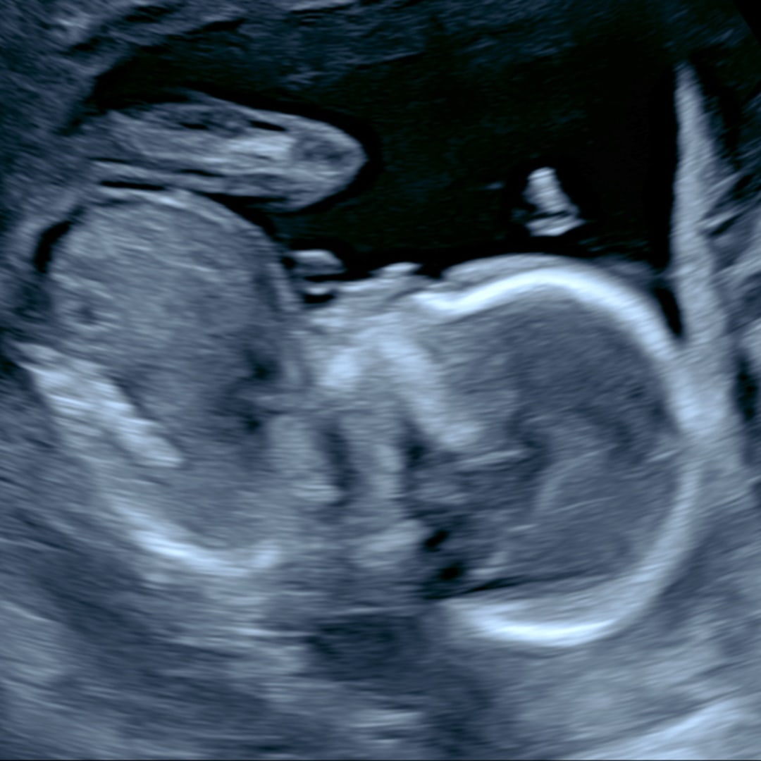 Photo shared by Madison for their Babylist baby registry.