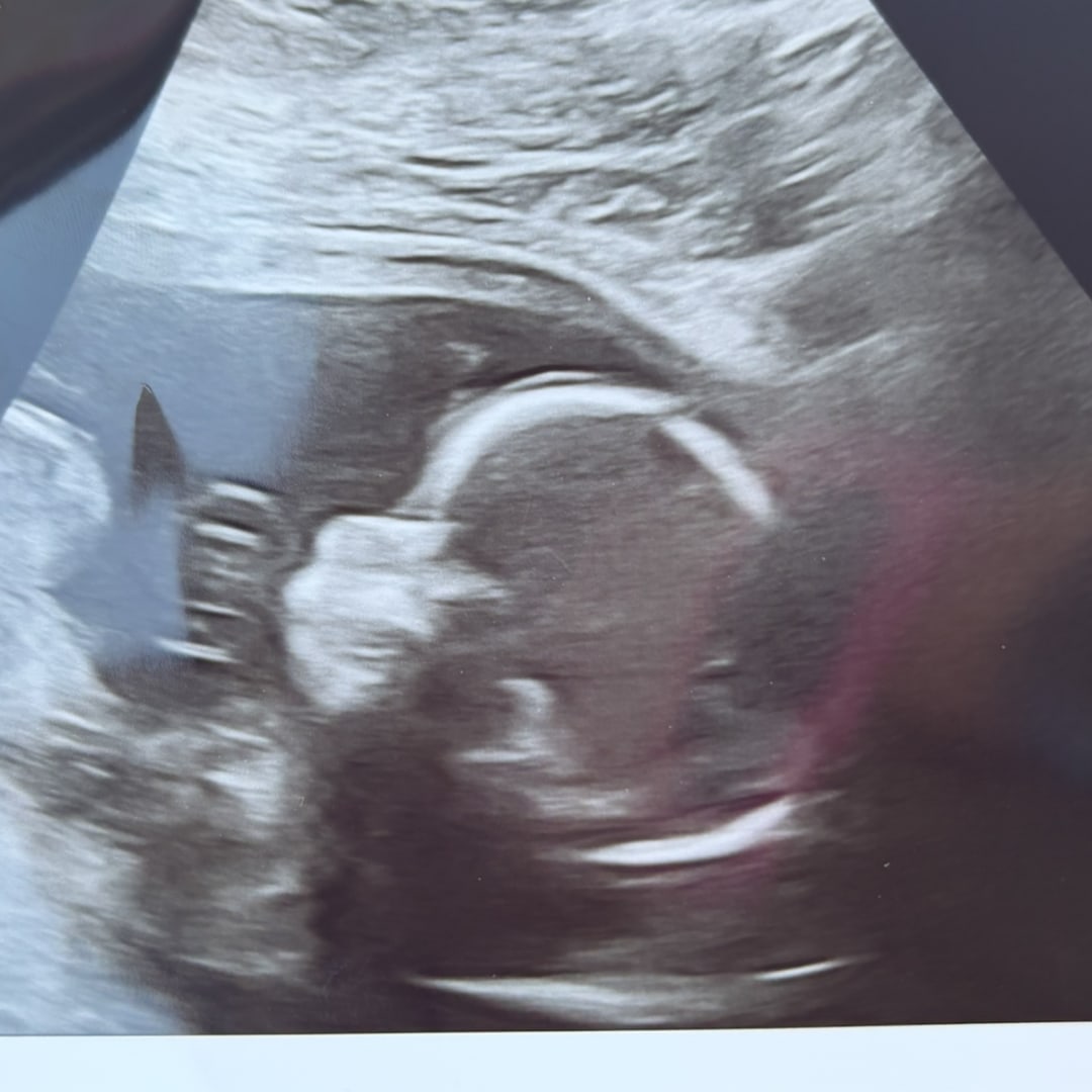 Photo shared by Brianna for their Babylist baby registry.