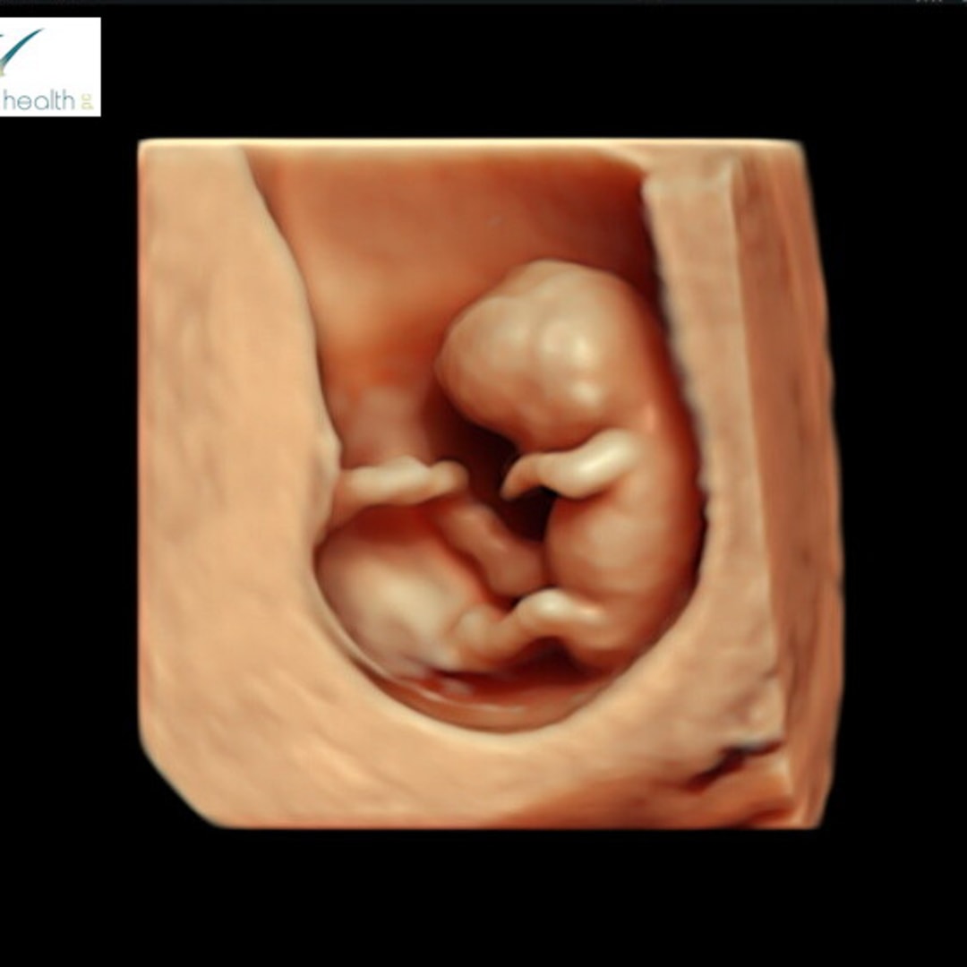 Photo shared by Makenna for their Babylist baby registry.