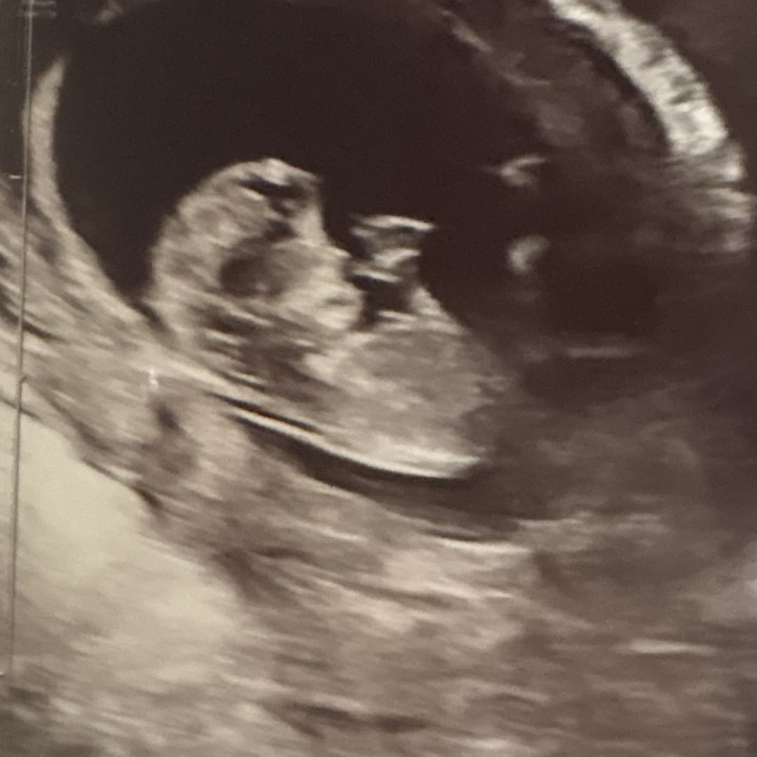 Photo shared by Becca for their Babylist baby registry.