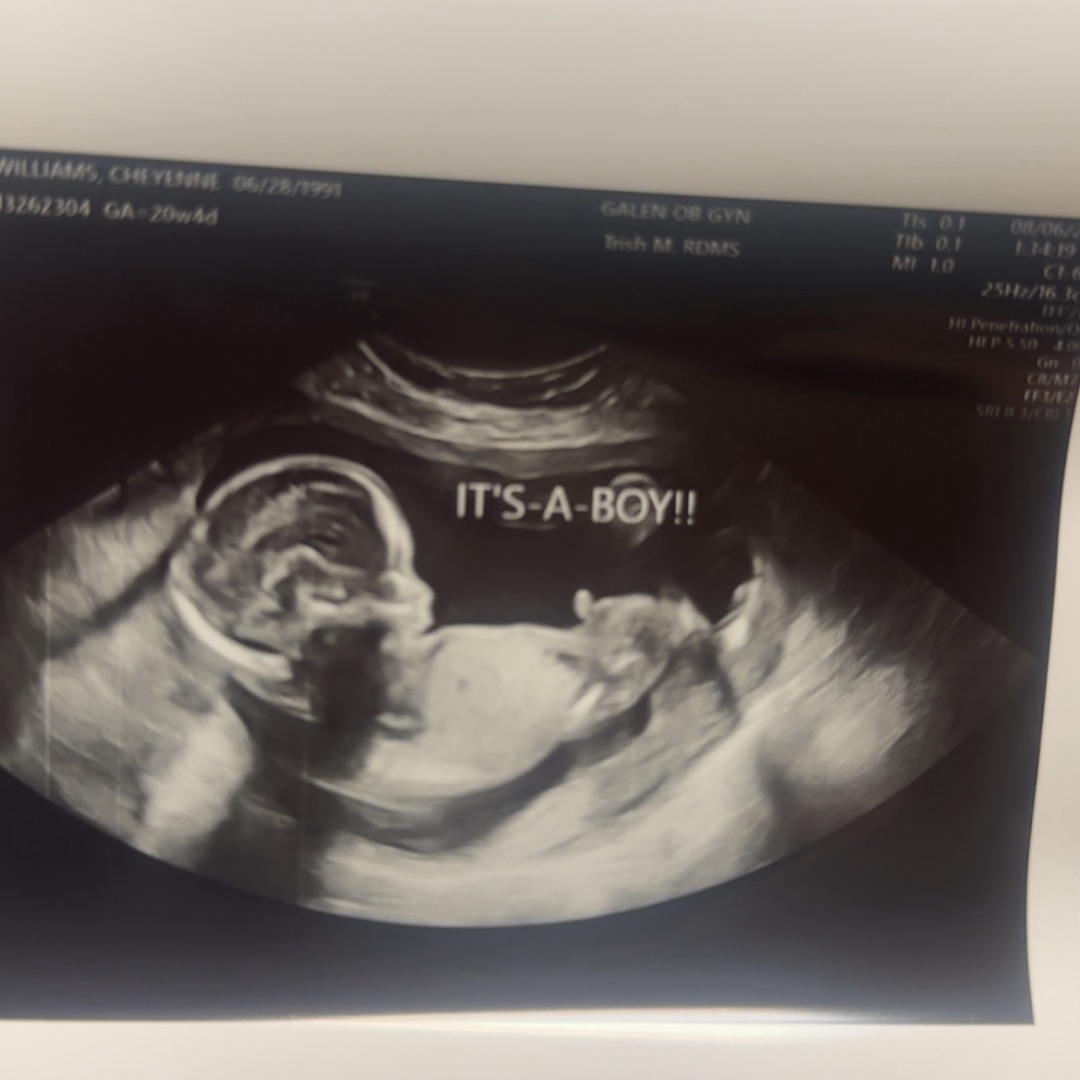 Photo shared by Cheyenne for their Babylist baby registry.