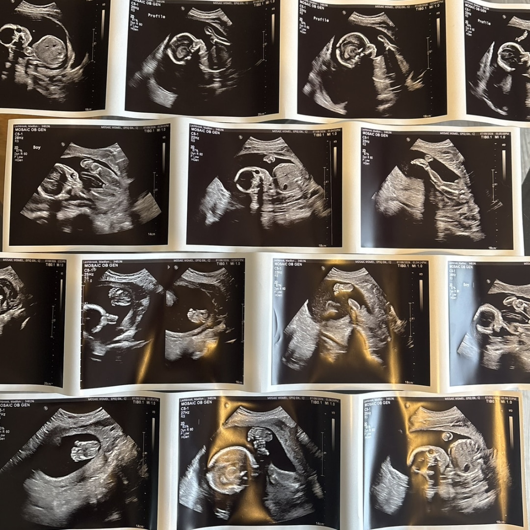 Photo shared by Madilyn for their Babylist baby registry.
