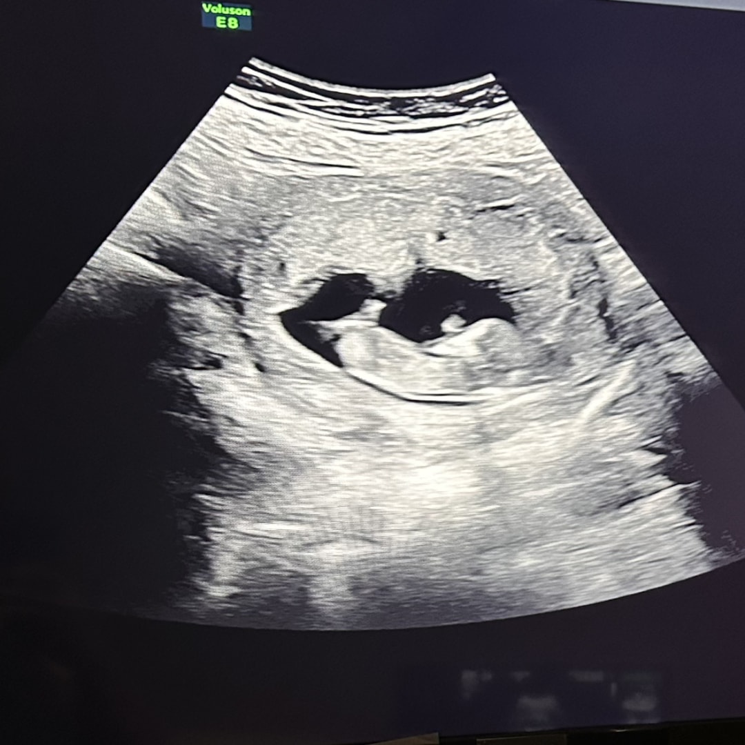 Photo shared by Tina for their Babylist baby registry.