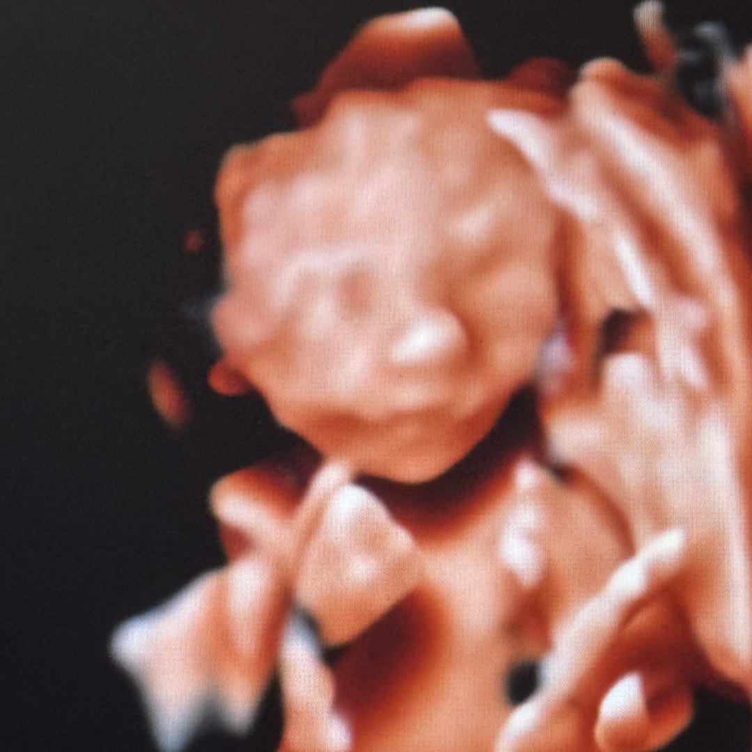 Photo shared by Sarah for their Babylist baby registry.