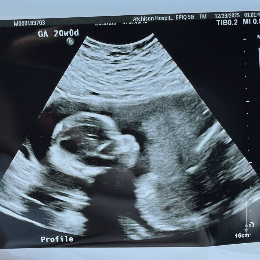 Photo shared by Lindsey for their Babylist baby registry.