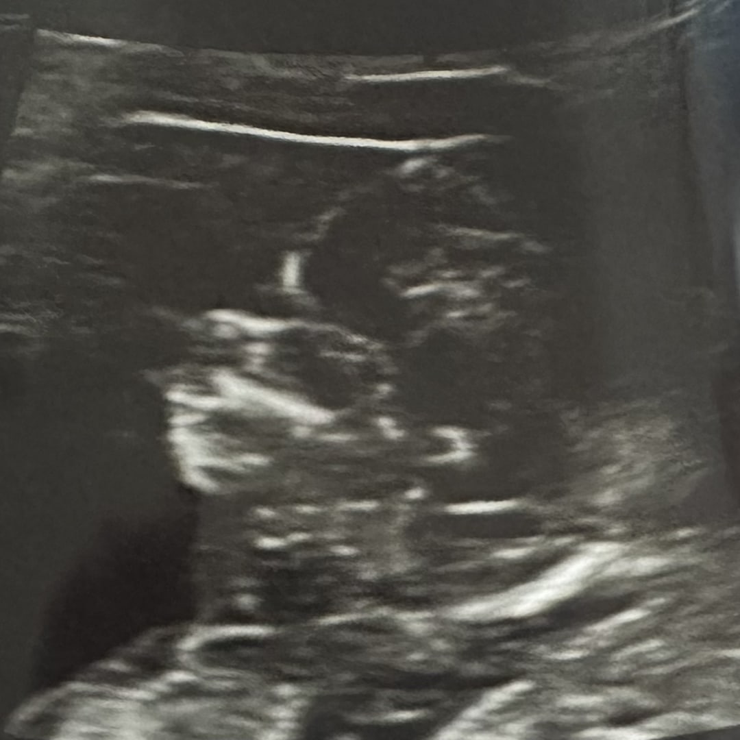 Photo shared by Liliana for their Babylist baby registry.