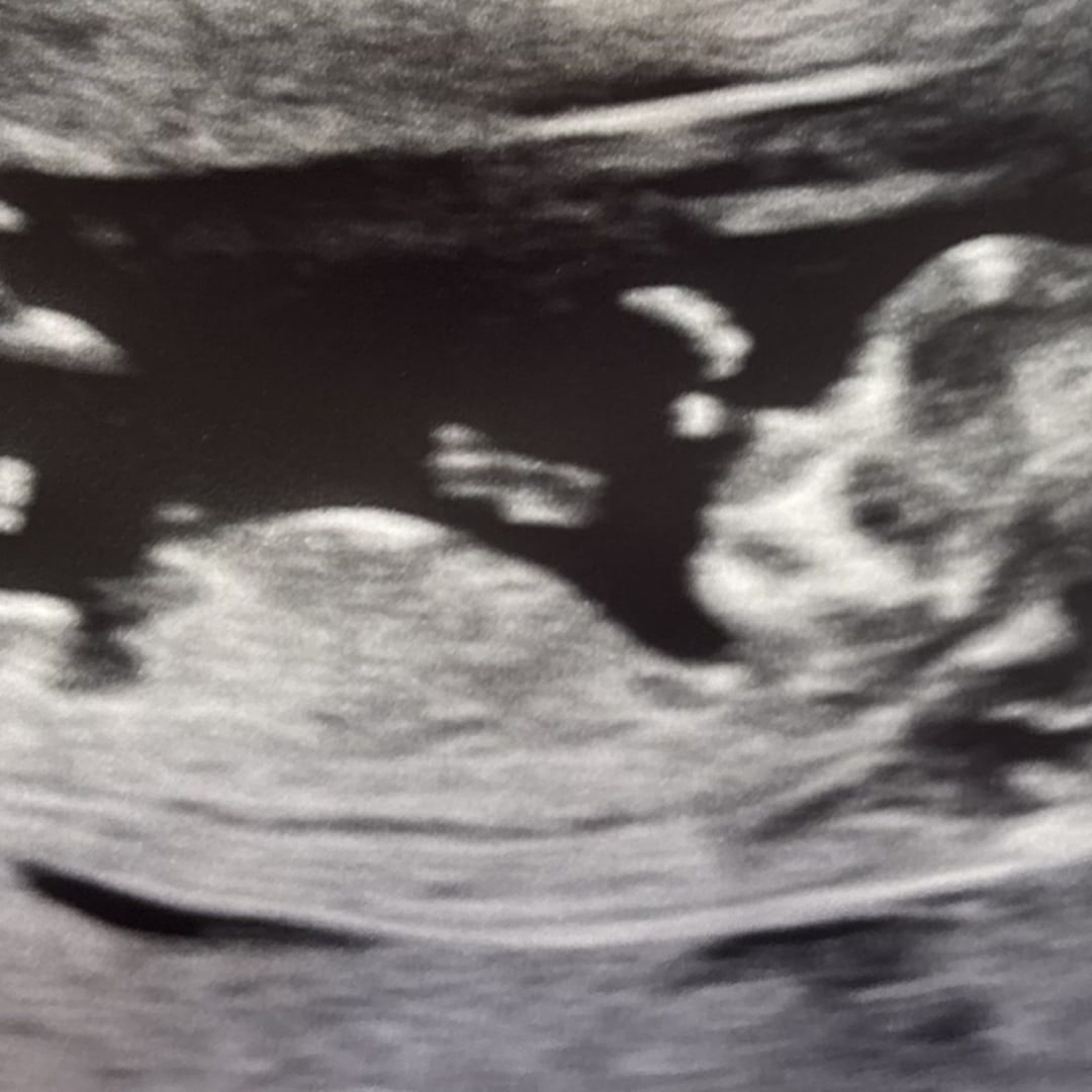 Photo shared by Melissa for their Babylist baby registry.