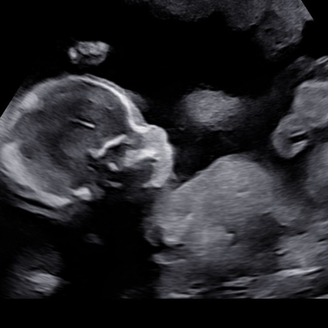 Photo shared by Adriana for their Babylist baby registry.