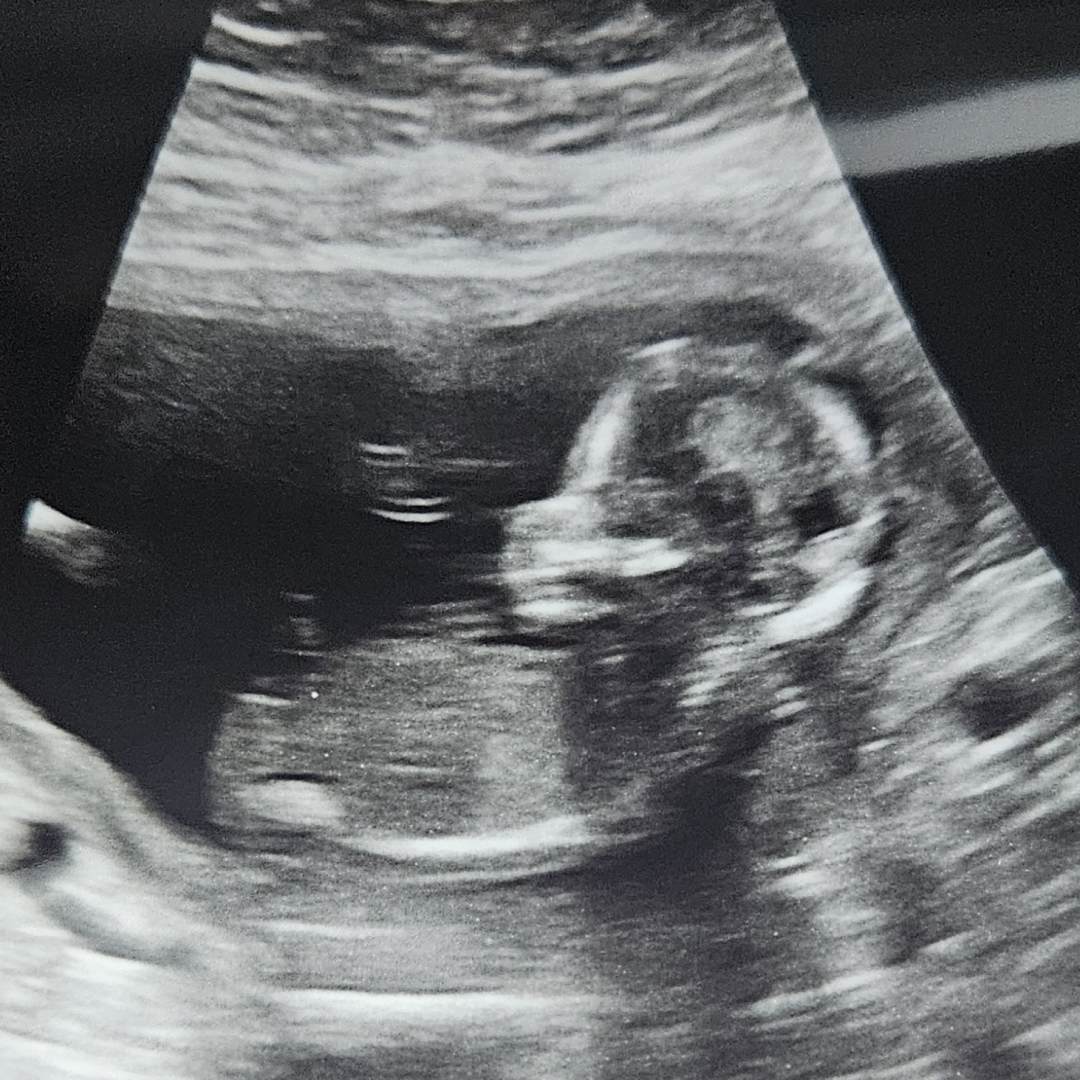 Photo shared by Katie for their Babylist baby registry.