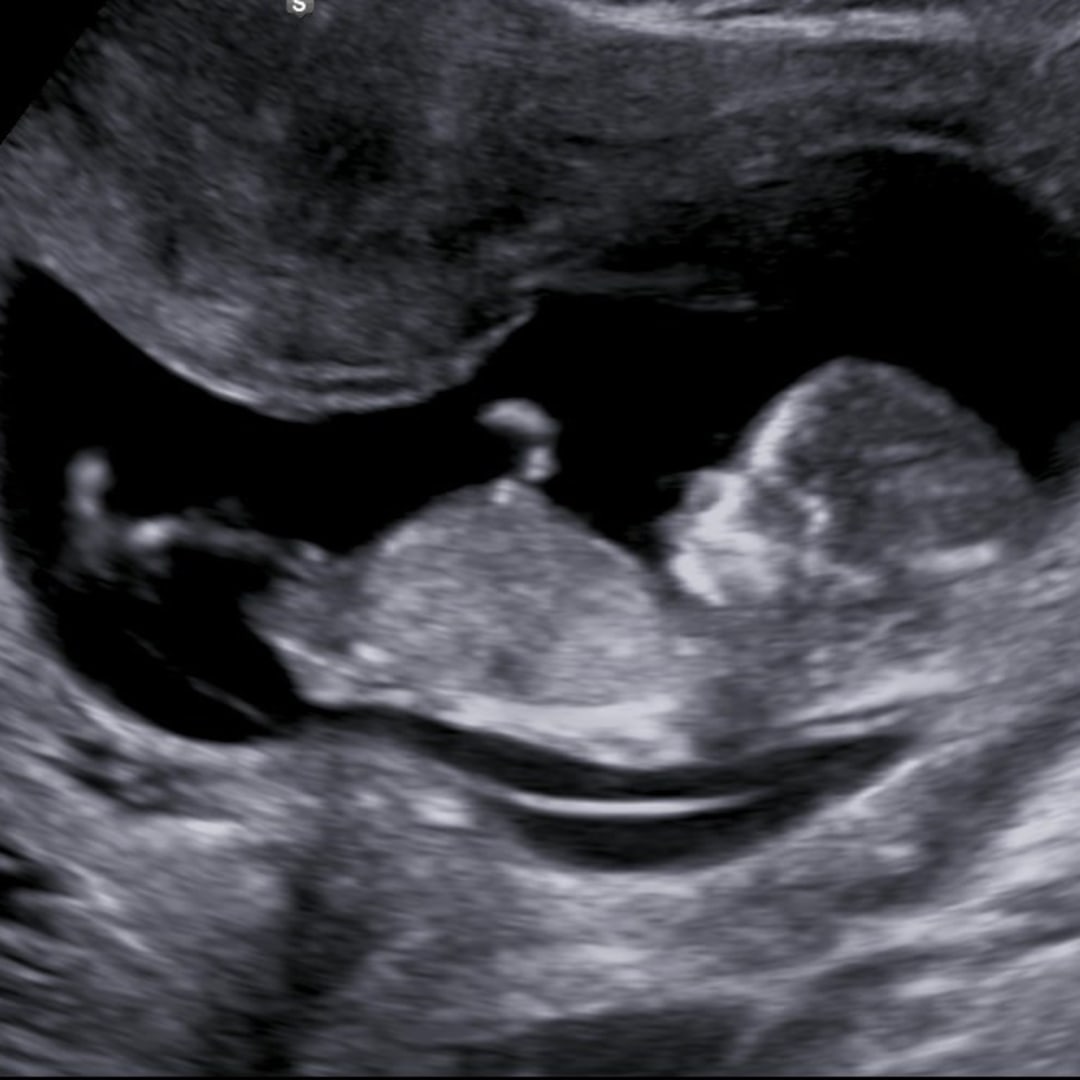 Photo shared by Matti and Zach for their Babylist baby registry.