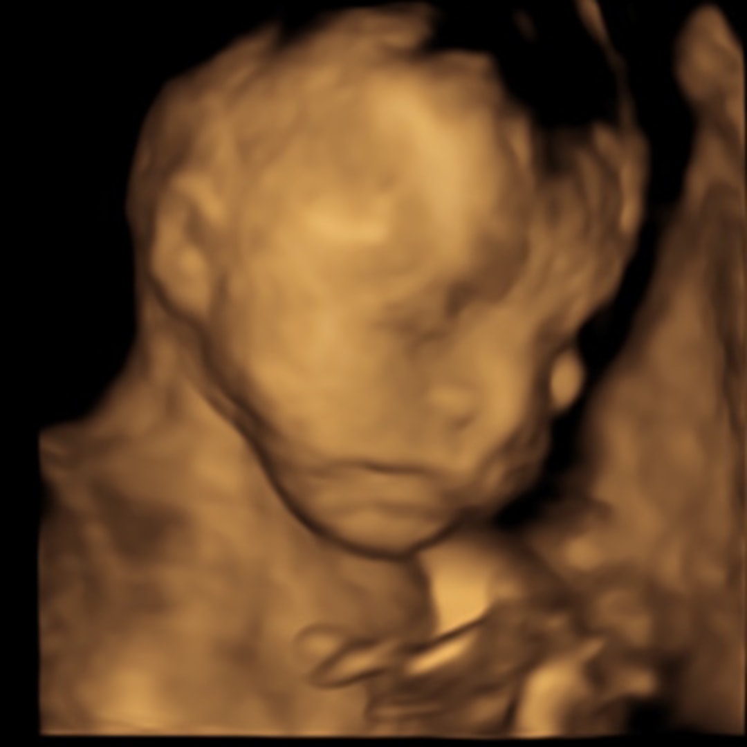 Photo shared by Karina for their Babylist baby registry.
