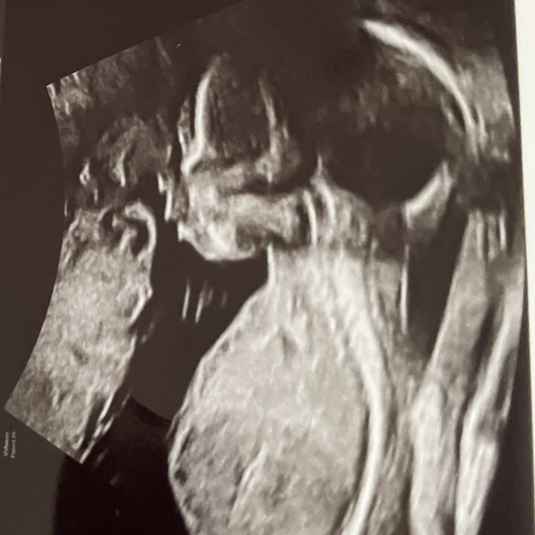 Photo shared by Vaniah for their Babylist baby registry.