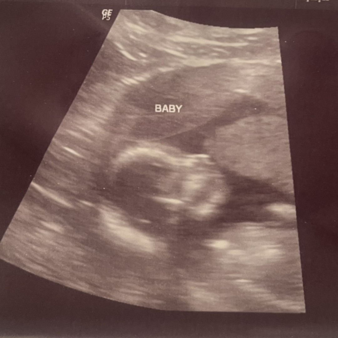Photo shared by Natalie for their Babylist baby registry.