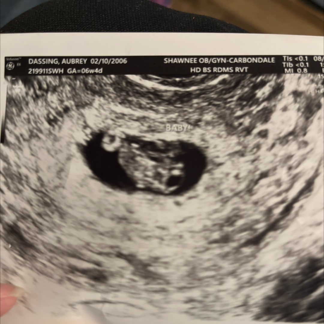 Photo shared by Aubrey for their Babylist baby registry.