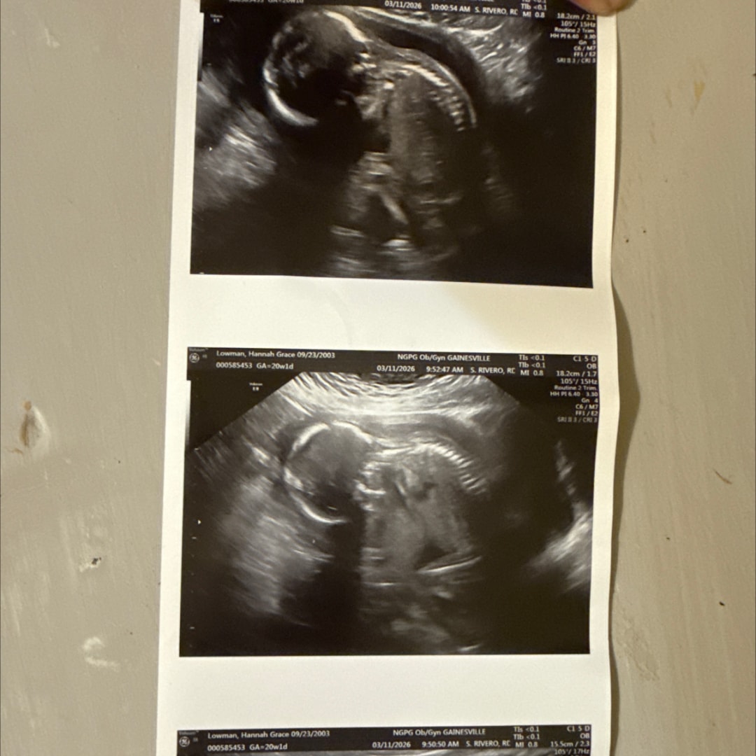Photo shared by Hannah for their Babylist baby registry.