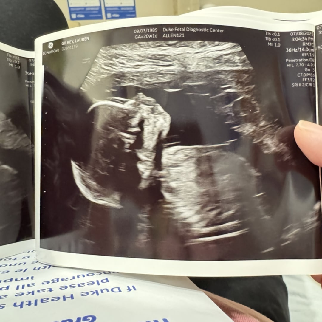 Photo shared by Lauren for their Babylist baby registry.
