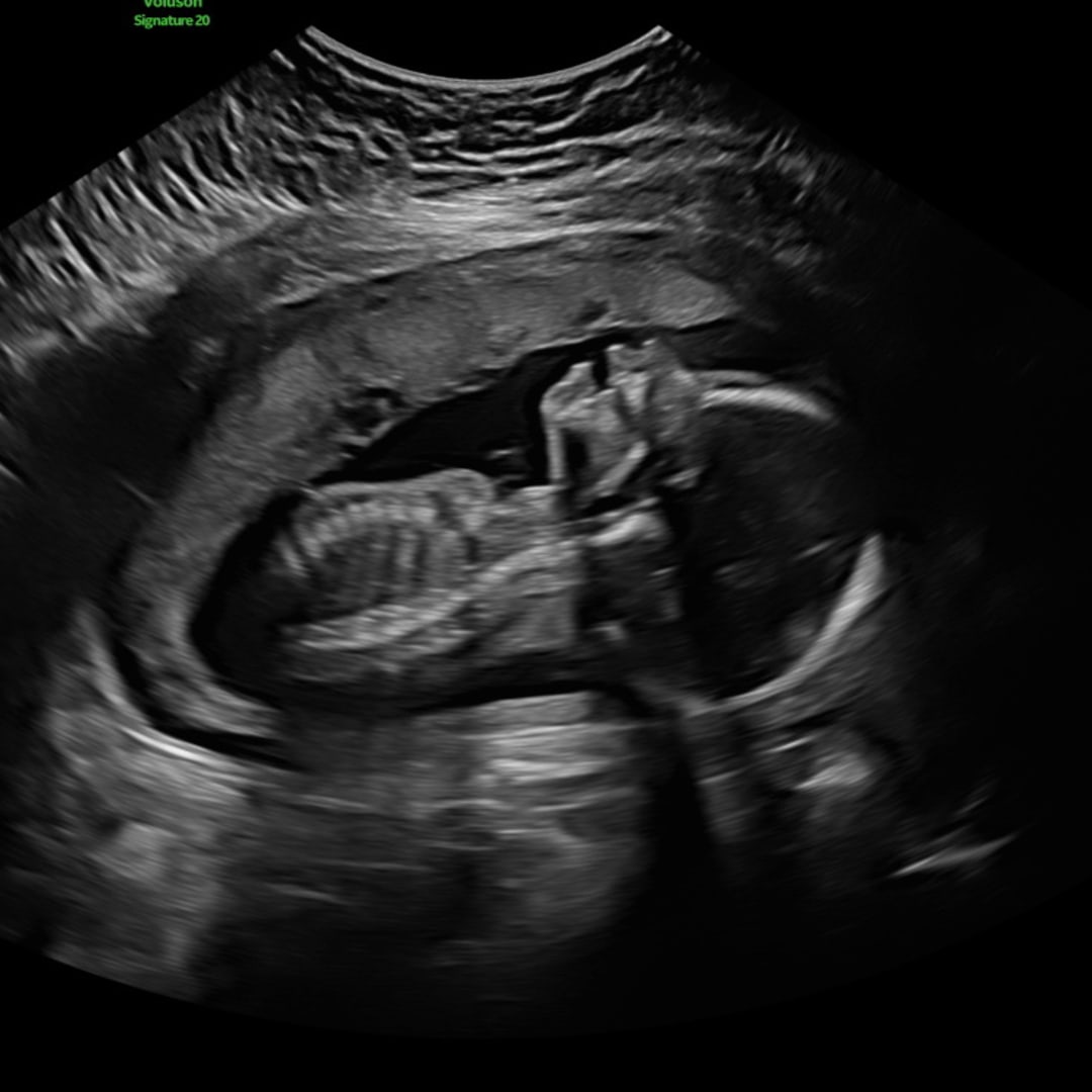 Photo shared by Breanna for their Babylist baby registry.