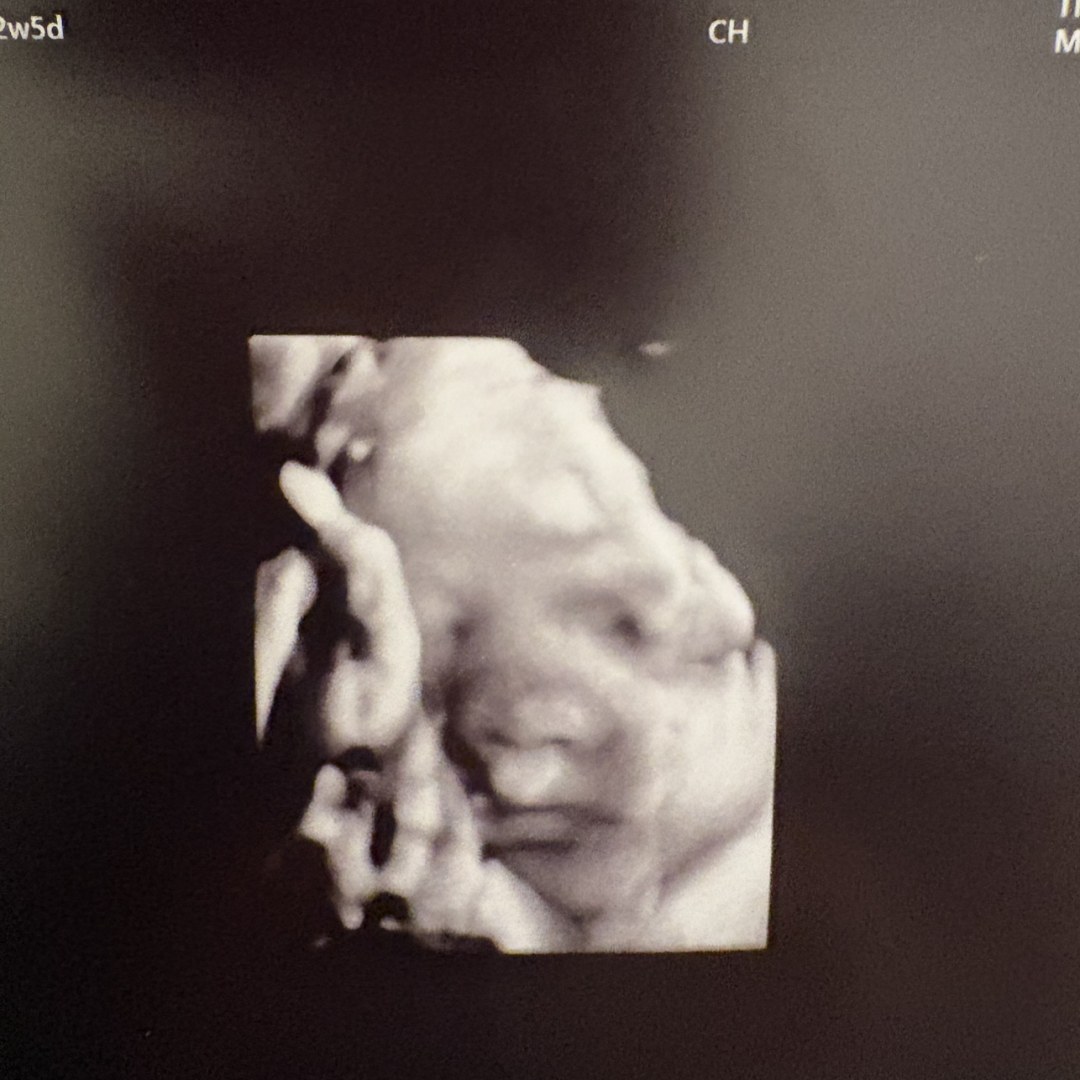 Photo shared by Bethany for their Babylist baby registry.
