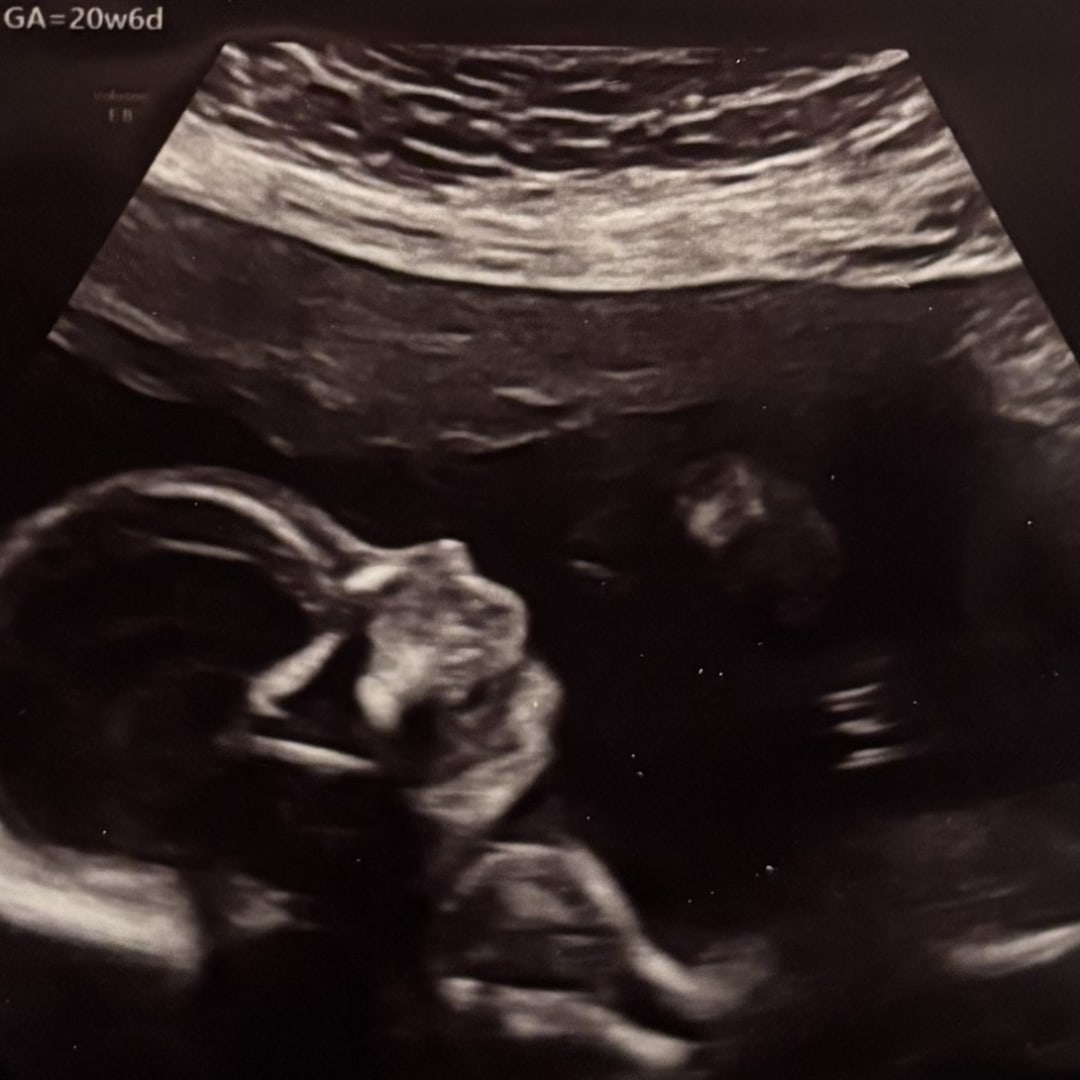 Photo shared by Jamisen for their Babylist baby registry.