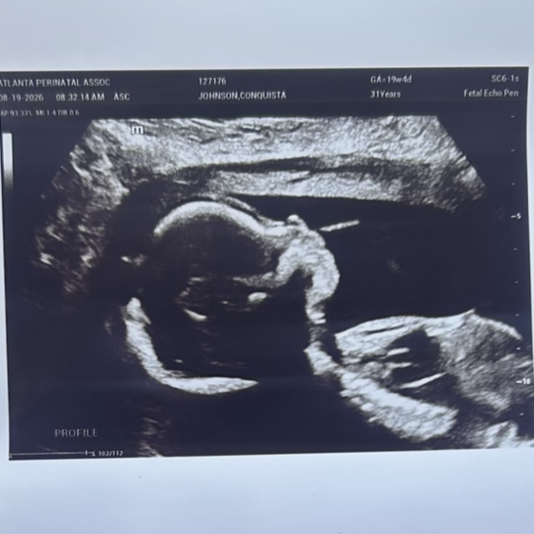 Photo shared by Conquista for their Babylist baby registry.