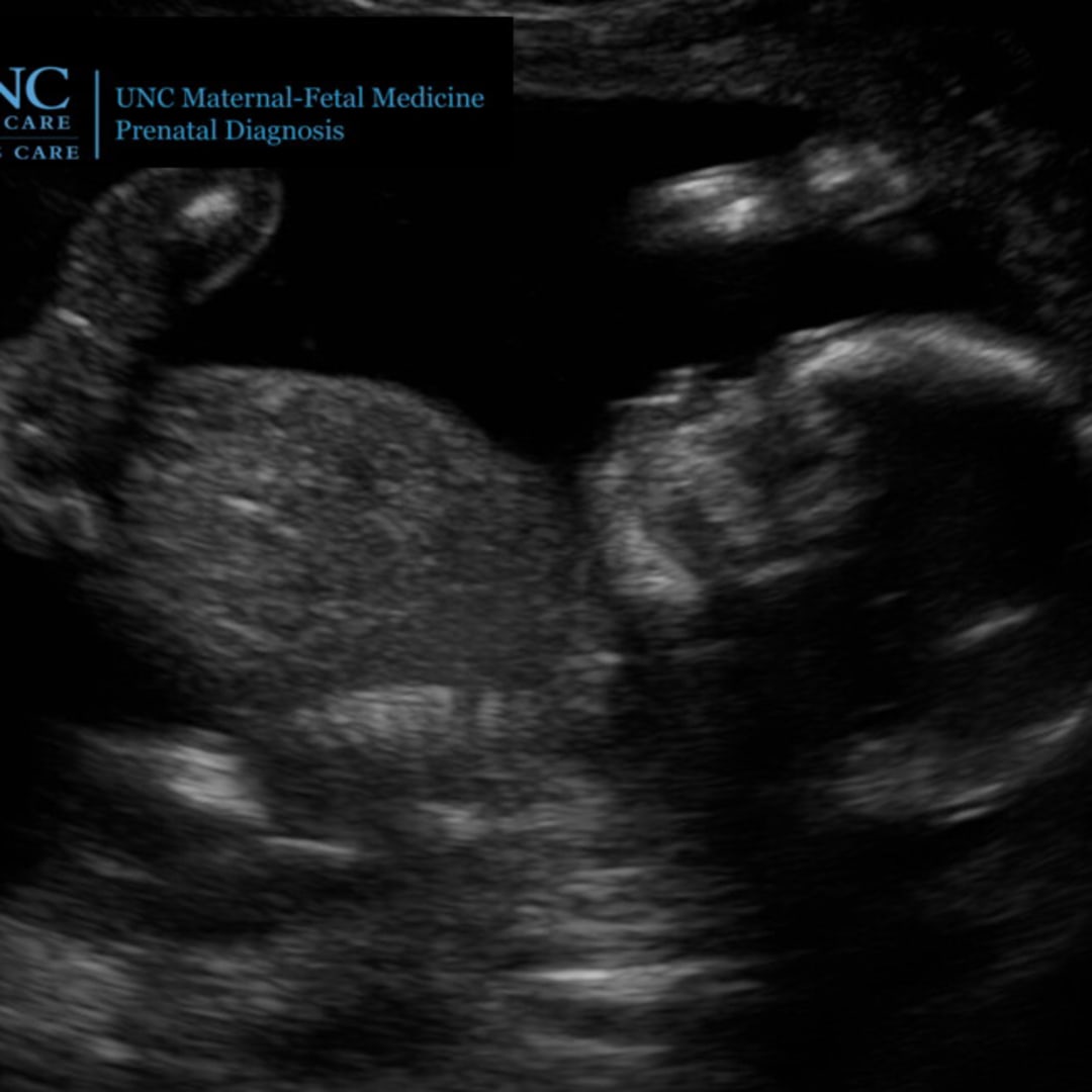 Photo shared by Jessie for their Babylist baby registry.
