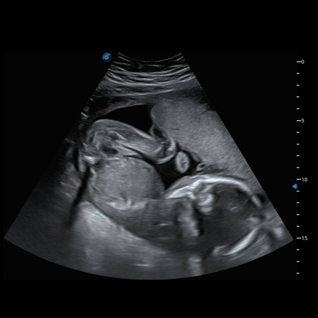 Photo shared by Mariah for their Babylist baby registry.