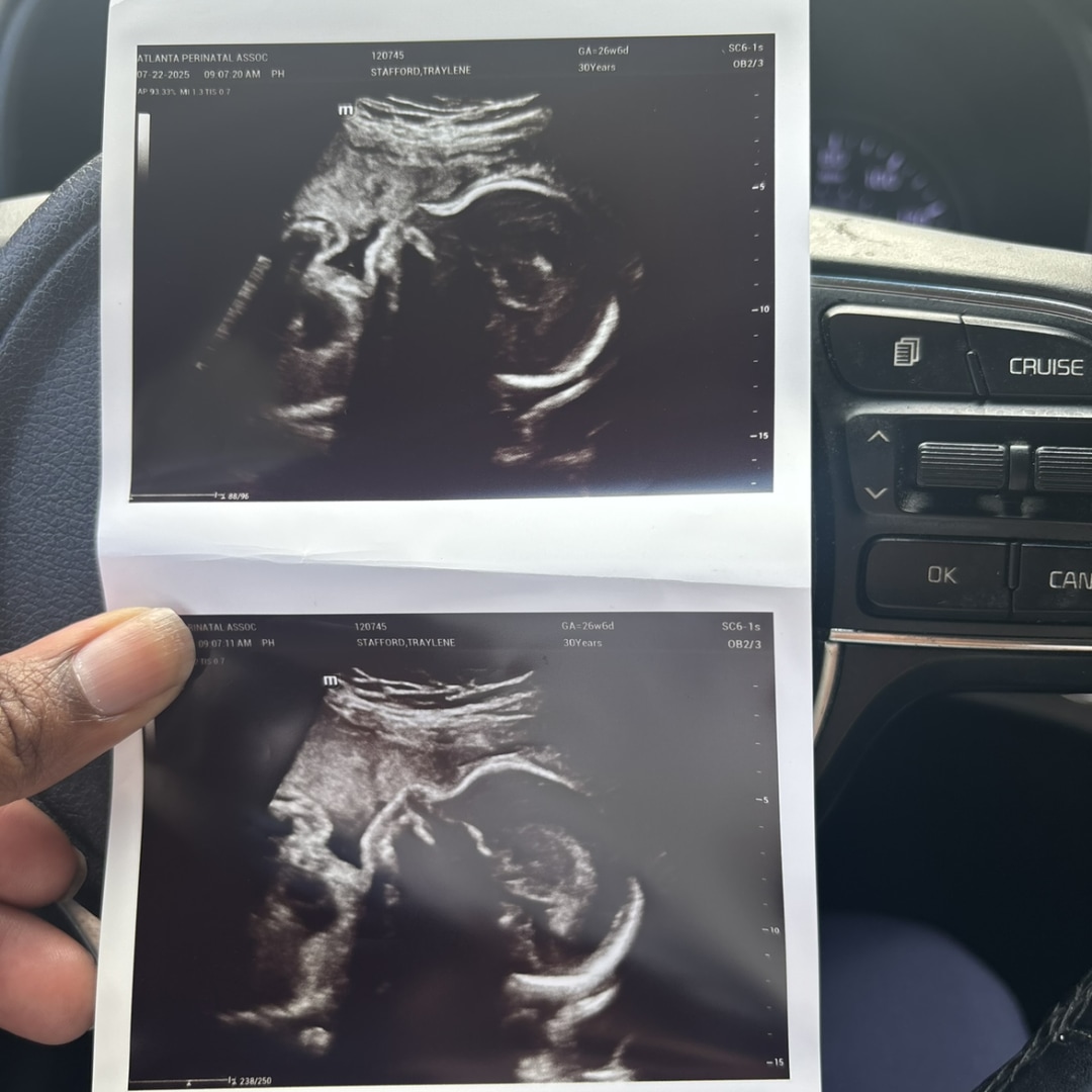 Photo shared by Traylene for their Babylist baby registry.