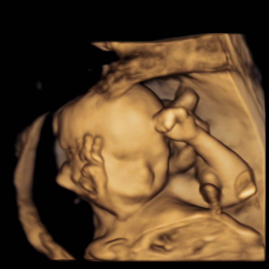 Photo shared by Tayler for their Babylist baby registry.