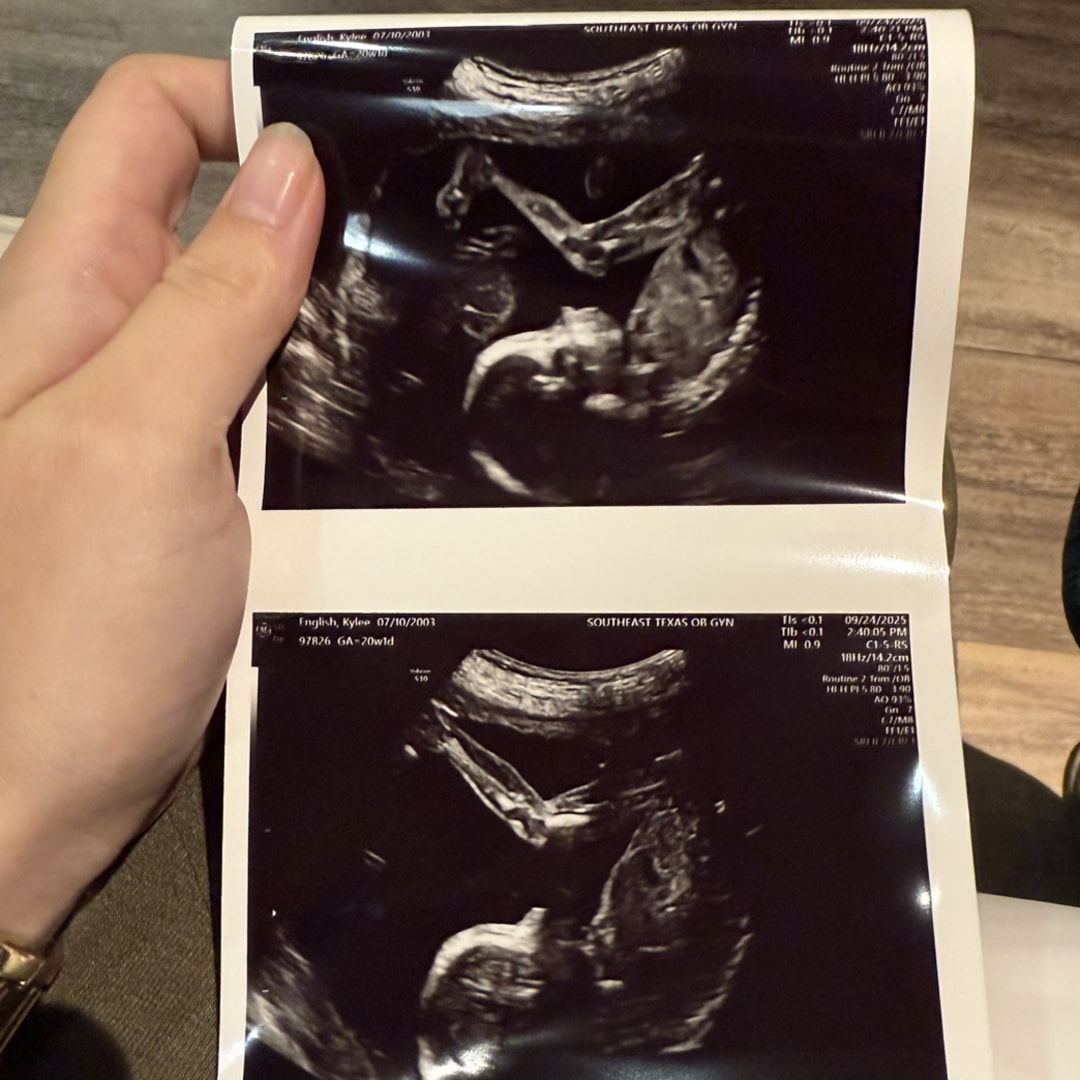 Photo shared by Kylee for their Babylist baby registry.