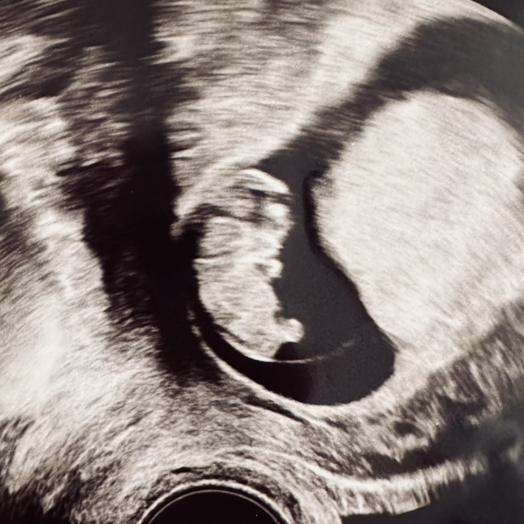 Photo shared by Gabriella for their Babylist baby registry.