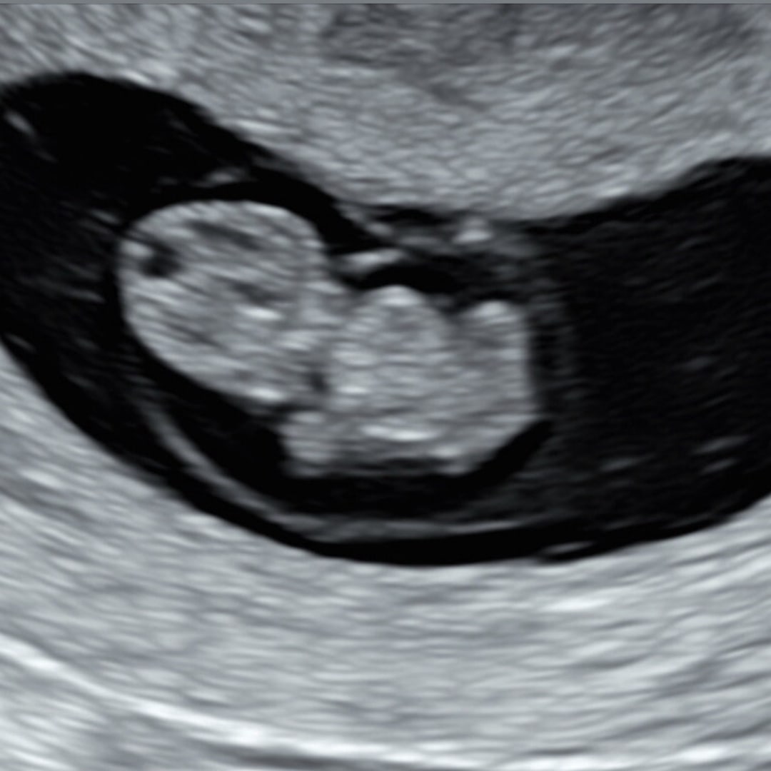 Photo shared by Isabel for their Babylist baby registry.