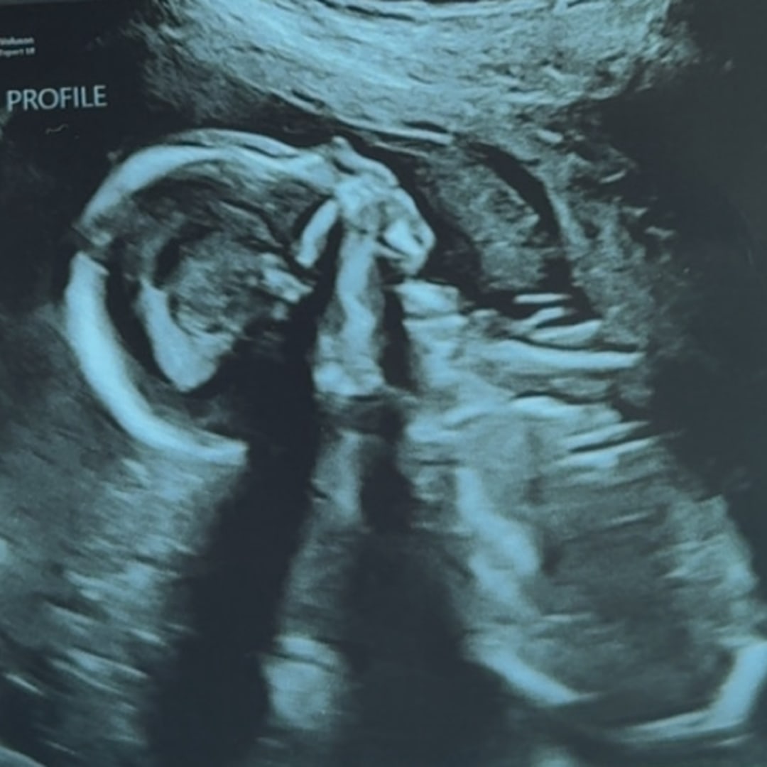 Photo shared by Naomi for their Babylist baby registry.