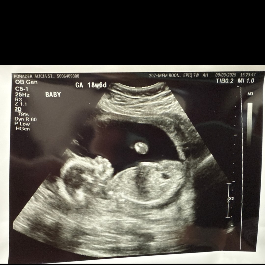 Photo shared by Alicia for their Babylist baby registry.