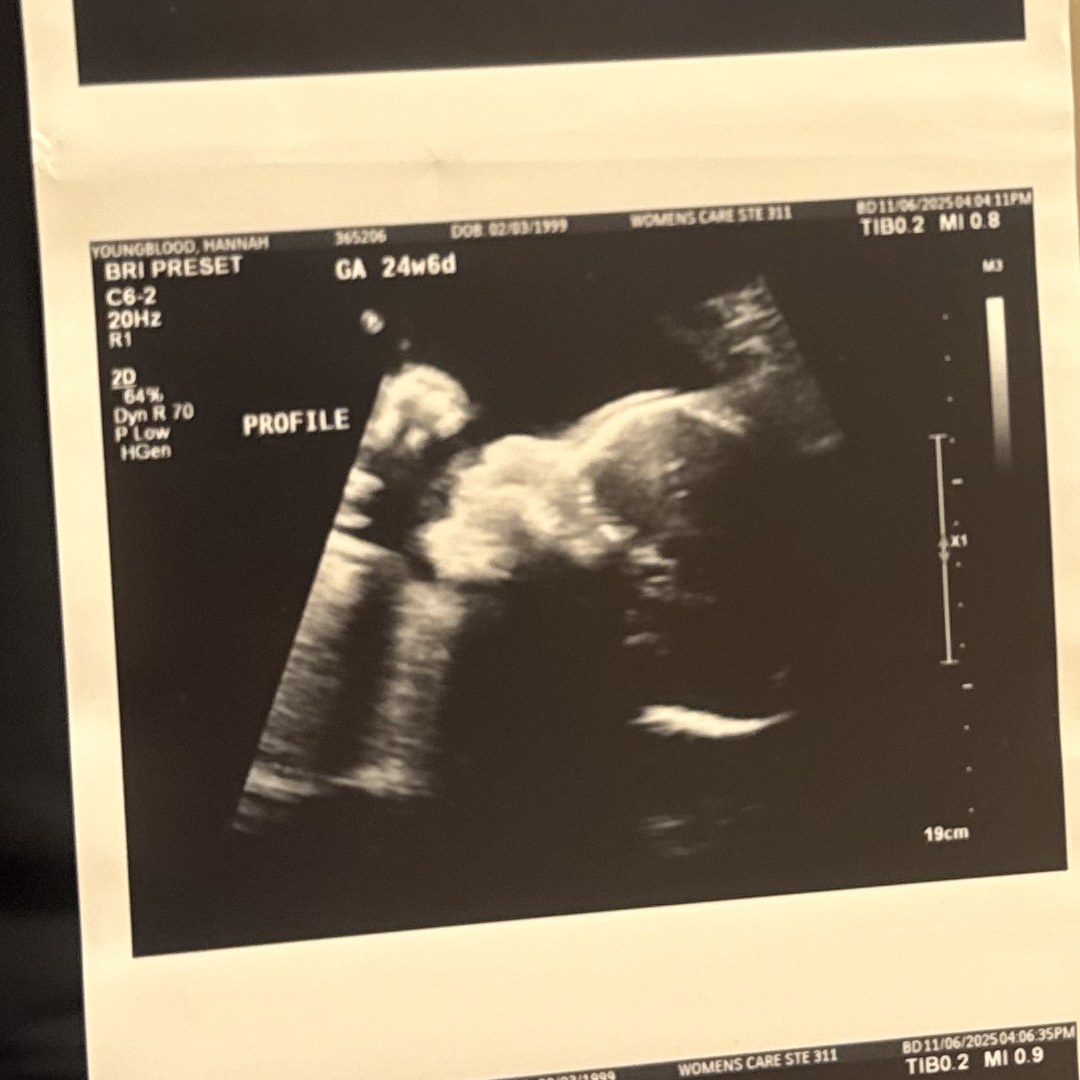 Photo shared by Hannah for their Babylist baby registry.