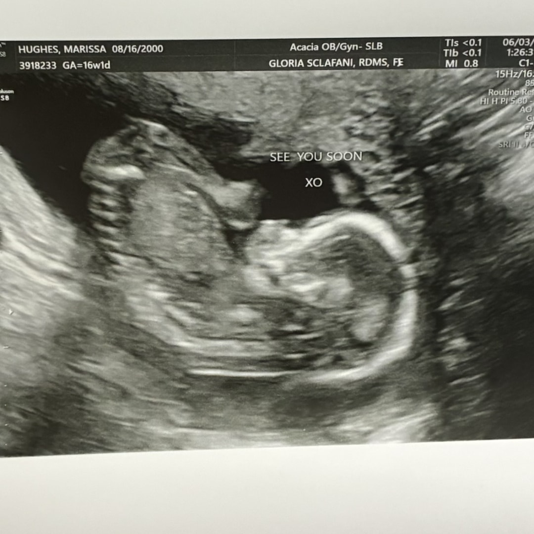 Photo shared by Marissa for their Babylist baby registry.