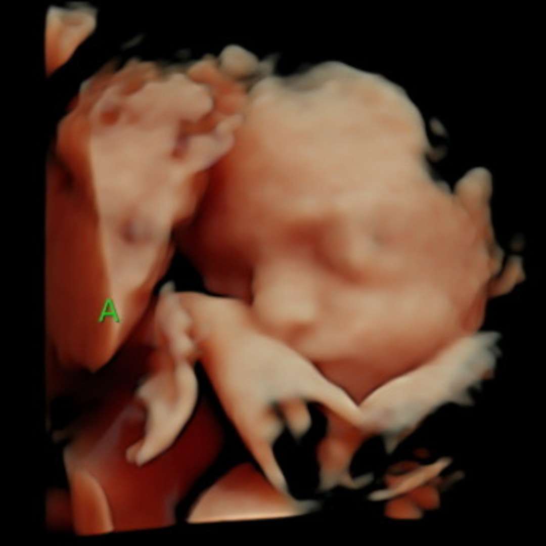 Photo shared by Emma for their Babylist baby registry.