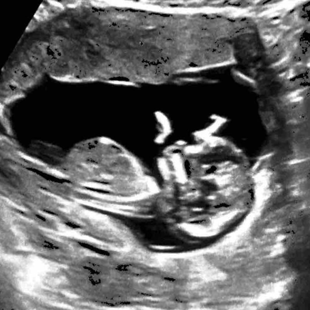 Photo shared by Melany for their Babylist baby registry.