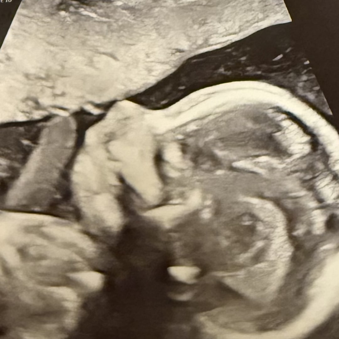 Photo shared by Julia for their Babylist baby registry.